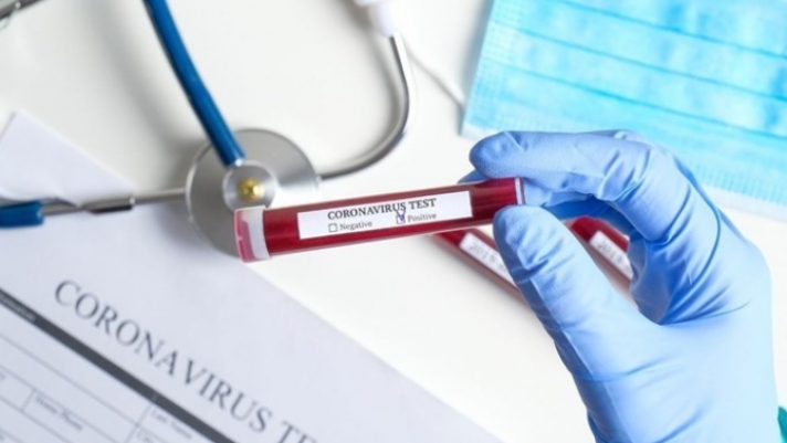 Κορονοϊός: 62χρονος Γάλλος έπαθε πριαπισμό - Ο ιός μπορεί να προκαλέσει στύση για περίπου τέσσερις ώρες
