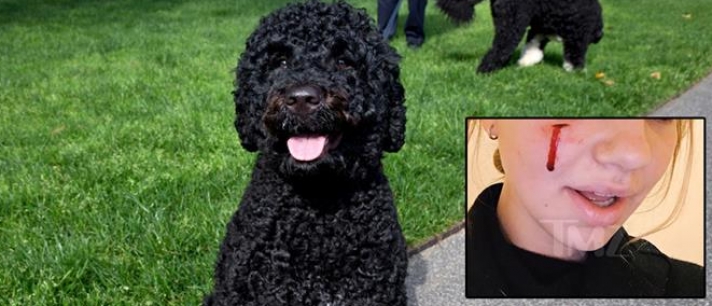 Η σκυλίτσα των Ομπάμα δάγκωσε μια 18χρονη (φωτο)