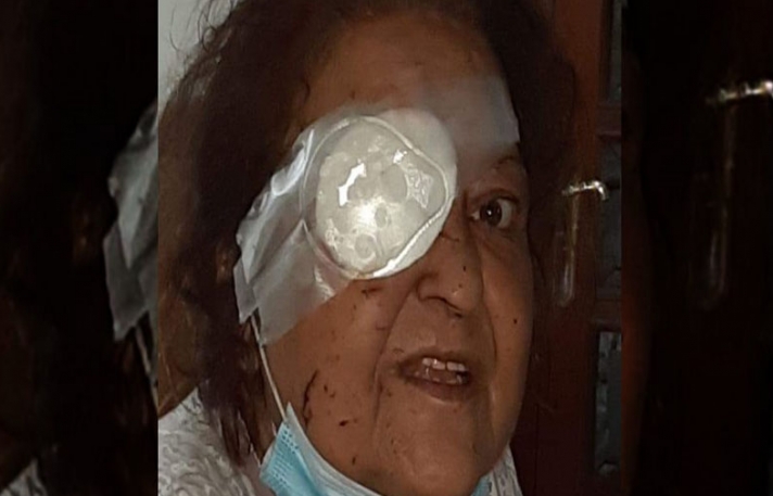 Συγκλονίζει η μαρτυρία Ελληνίδας από τη Βηρυτό: Έχασα το μάτι μου, το σπίτι μου καταστράφηκε (ΒΙΝΤΕΟ)