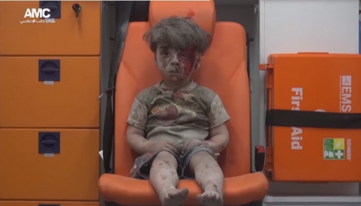 Το βλέμμα του μικρού Ομνάρ που συγκλονίζει τον πλανήτη (video)