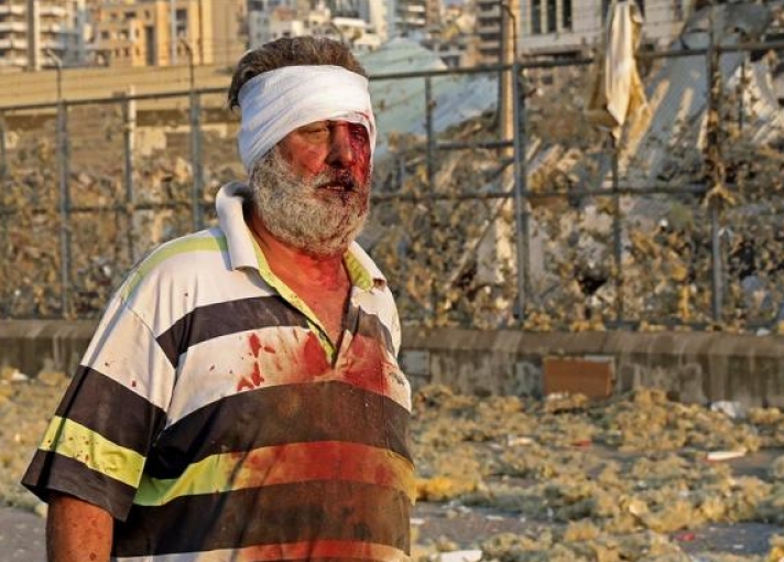 Βηρυτός: Οι πρώτες υποψίες για την αιτία της έκρηξης