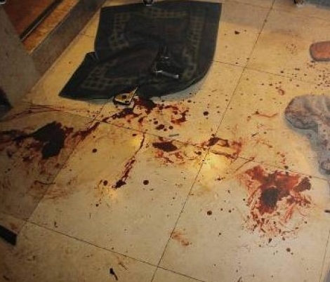 Θεσσαλονίκη: Νεκρός μετά από καβγά για... φασαρία στην πολυκατοικία